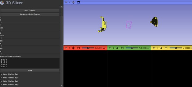 3D Slicer UI prototype showing robot pose visualization and path planning interface for MRI-guided procedures